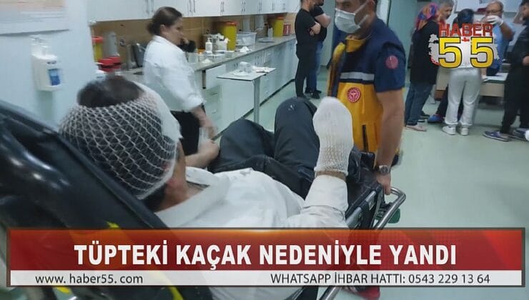 SAMSUN’DA TÜP PARLAMASI SONUCU 1 KİŞİ YANARAK HASTANELİK OLDU